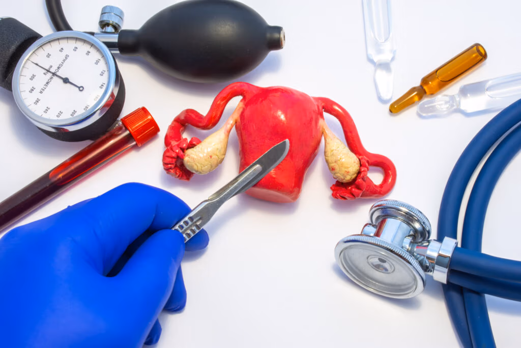 Specialized Endometrioma Excision near Boston Massachusetts, New England